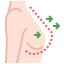 augmentation