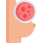 Cancer / Oncology breast cancer
