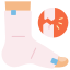 fracture