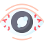 glaucoma